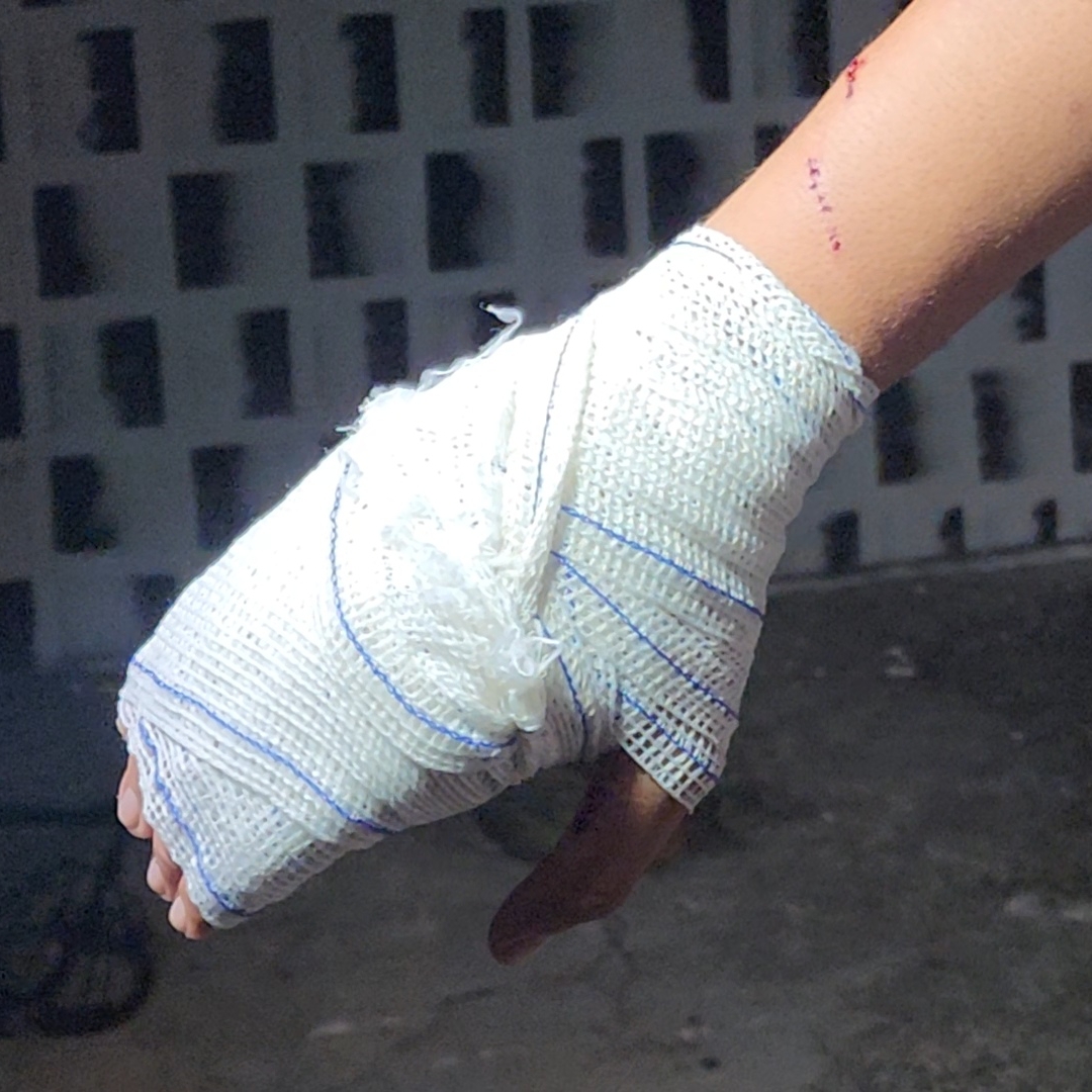 JOVEM É ATACADO POR PITBULL E FICA FERIDO NA ZONA LESTE DE LONDRINA